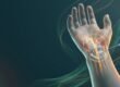 Karpaltunnelsyndrom ohne OP: Handgelenk mit Mittelnerv und Injektion unter Ultraschall
